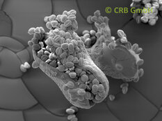 Aufgeplatzte Samenkapsel von Euphorbia leuconeura | © CRB Analyse Service GmbH